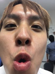 写真１