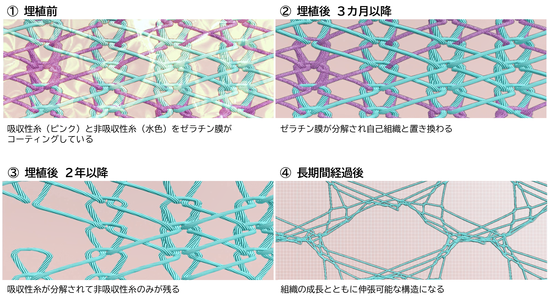 20240826synfolium_2.png
