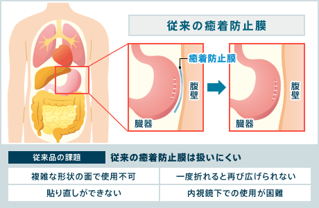 従来の癒着防止膜