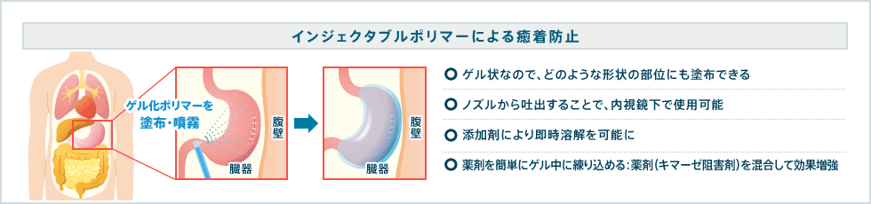 インジェクタブルポリマーによる癒着防止