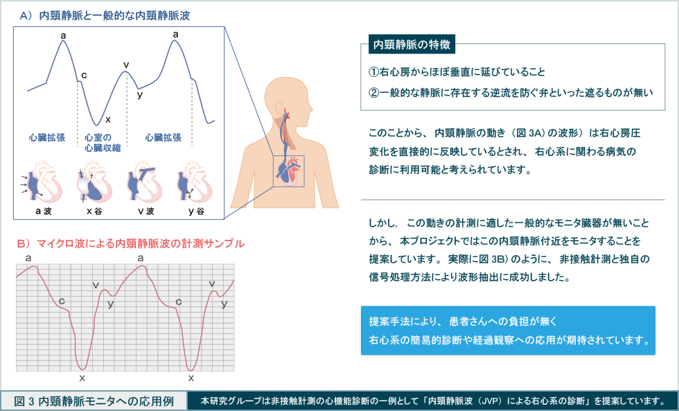  図3　内経静脈モニタへの応用例