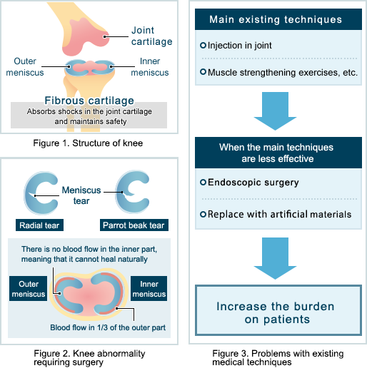 Fig. 1 Mechanism of the knee / Figure 2 Anomalies of the knee requiring treatment / Figure 3 Problems of conventional therapy