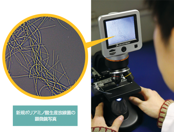 新規ポリアミノ酸生産放線菌の顕微鏡写真
