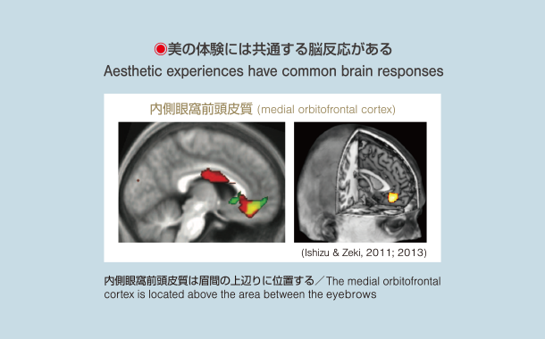 美の体験は共通する脳反応がある