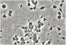 神経細胞の顕微鏡画像